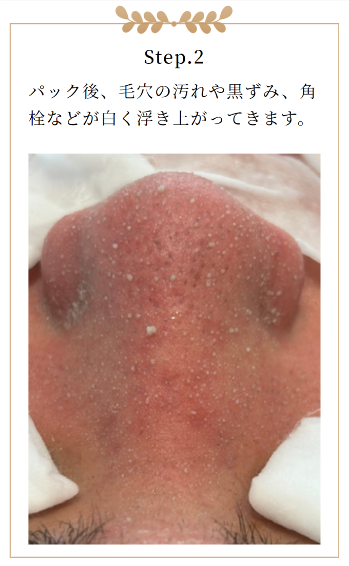 毛穴洗浄ビフォー